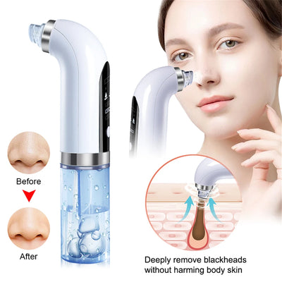 Say goodbye to stubborn blackheads and clogged pores with our powerful 400mAh Electric Blackhead Cleaner. 