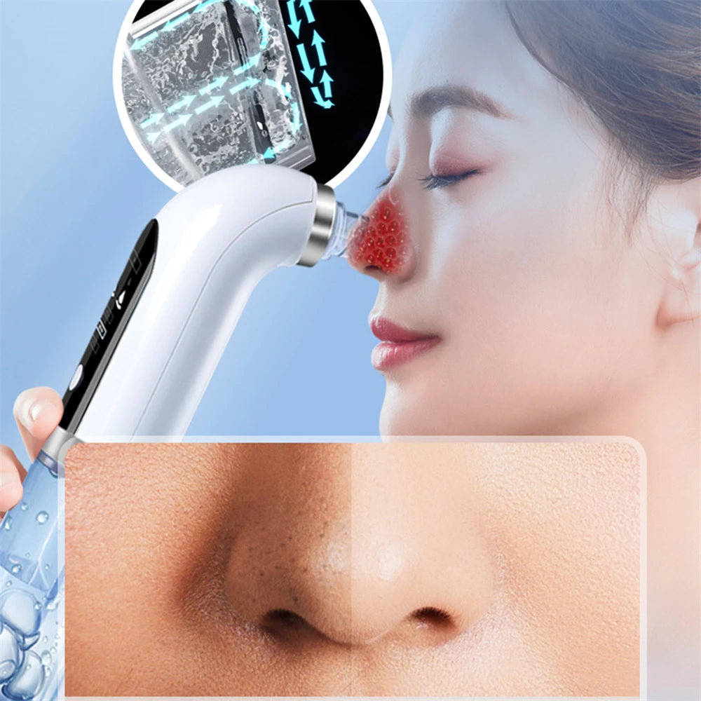 Say goodbye to stubborn blackheads and clogged pores with our powerful 400mAh Electric Blackhead Cleaner. 