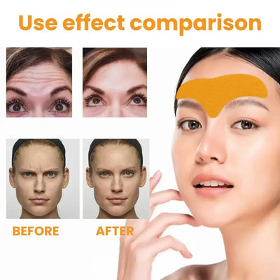 Introducing our Anti-Wrinkle Forehead Patch, your ultimate solution for smooth, youthful skin. 